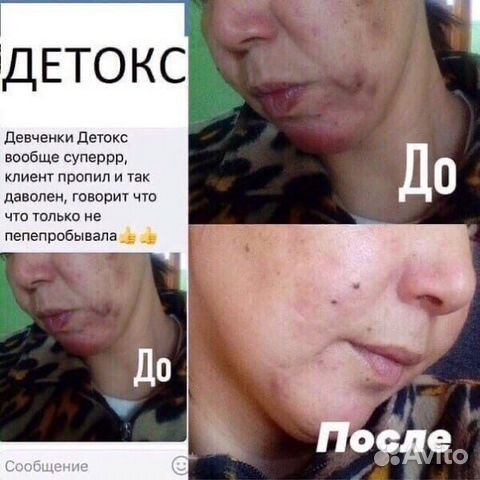 Программа очищения организма Детокс