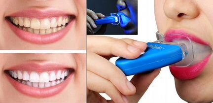 Домашнее отбеливание зубов White Light